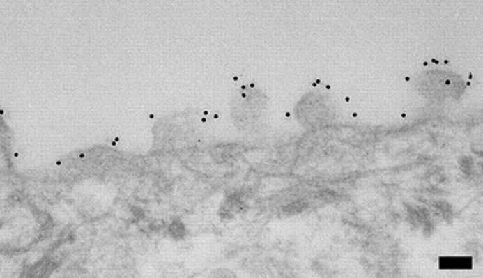 Localization of MUC16 in stratified HCLE cell cultures with 12 nm ImmunoGold