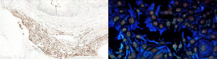 Colorimetric vs Fluorescent Immunohistochemistry