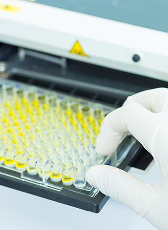 Scientist is putting ELISA plate to measure OD with micro plate reader