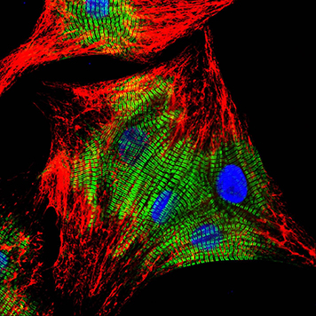 Neonatal Rat Cardiomyocytes Stained with Cross-adsorbed JIR Secondaries