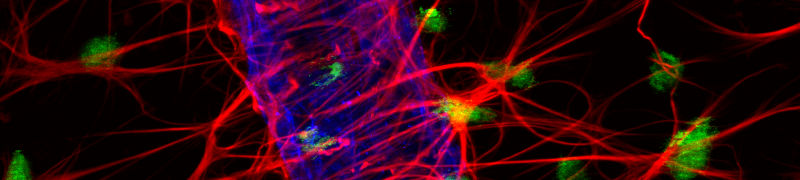 IF image of rat retinal tissue visualized with JIR Alexa Fluor®-conjugated secondary antibodies