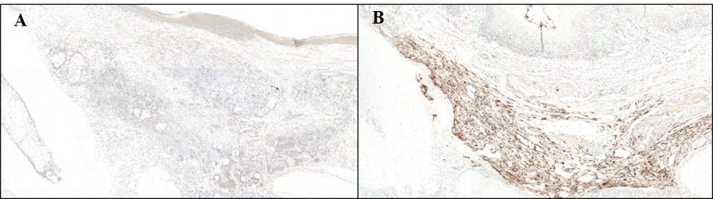 IHC staining with JIR